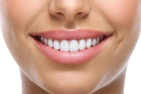 Foto da boca de mulher branca com sorriso alinhado e dentes brancos.